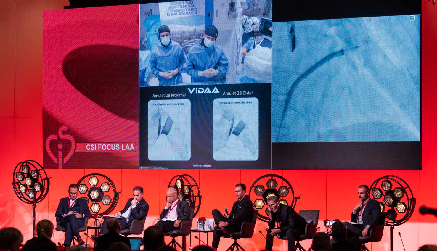 VIDAA: Innovació pionera en cirurgia cardíaca al congrés CSI LAA focus de Frankfurt utilitzant un cor virtual