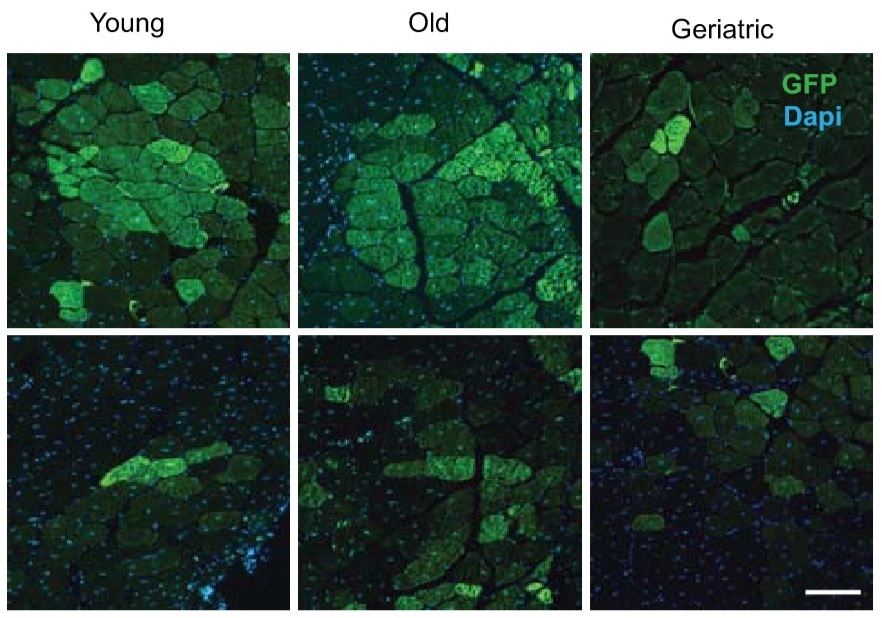 Researchers identify a subgroup of stem cells that resists ageing and maintains muscle regeneration capacity until geriatric age