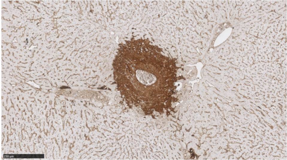 Histological view of a lesion caused by non-thermal radiofrequency ablation in a rabbit liver (photo: BERG-UPF)