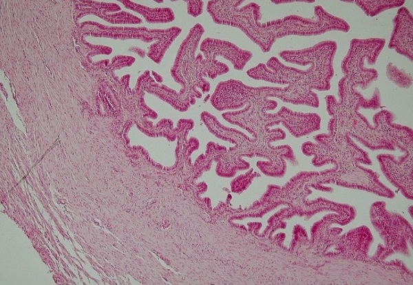 The study provides a novel molecular mechanism to explain a long-standing issue. Source: Department of Histology, Jagiellonian University Medical College