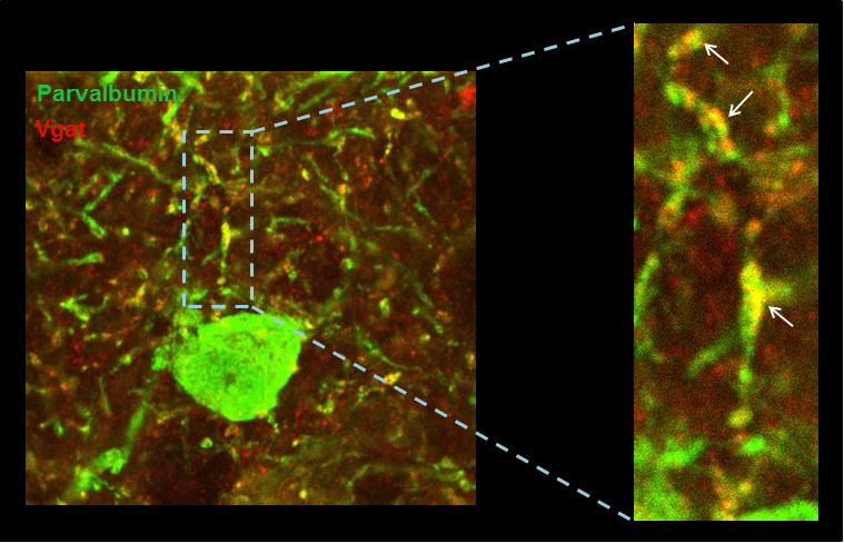 L’activitat de la neurona inhibitòria (verd) està controlada pels contactes  de  tipus  inhibidor  (vermell)  que  rep. Aquest control s’ha  vist  afectat  en  l’escorça  cerebral  del model de ratolí  de  síndrome  de  Down.