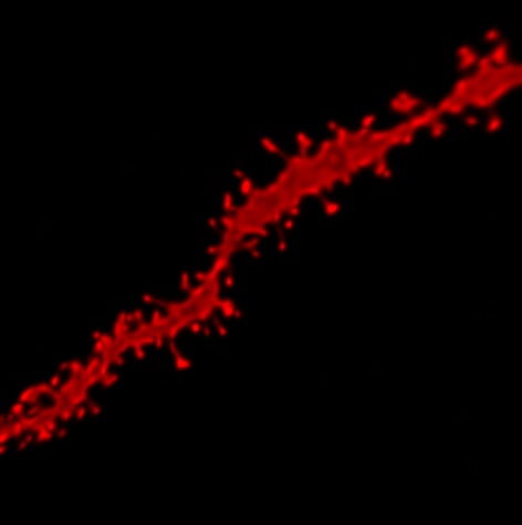 Espines dendrítiques NeuroPhar Espines dendrítiques