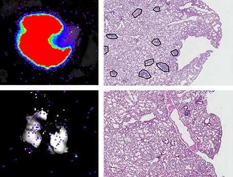 Detection of metastasis of breast cancer cells that emit light in the lung of mice (left); normal cells and cells without USP27X (right), metastases are marked with circles.