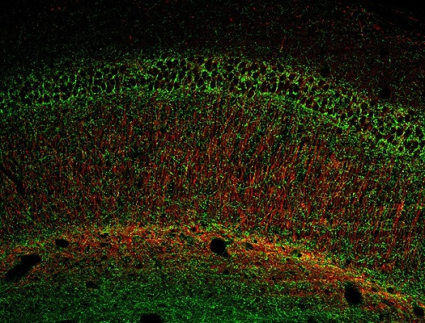 Detección del receptor cannabinoide CB1 (verde) y de la proteína MAP-2 (rojo) en el hipocampo de un ratón modelo de síndrome de Down. Fuente: UPF