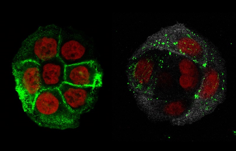 Células de colon cultivadas en el laboratorio y diferenciadas selectivamente para acumular moco. En la imagen, los núcleos de las células se muestran en rojo, el esqueleto de la célula (actina) en verde y, en la imagen de la derecha, se aprecian los gránulos de moco. Autor: Gerard Cantero-Recasens, CRG.