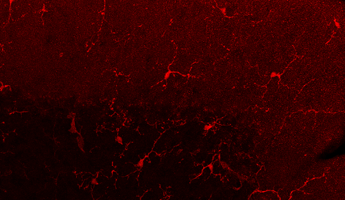 Imagen de microscopía que muestra células de la microglía en la corteza del cerebelo de ratón. Imatge inicial - Imagen de microscopía que muestra células de la microglía en la corteza del cerebelo de ratón.