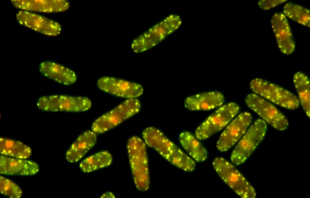 Agregados de proteínas que aparecen en células de levadura Schizosaccharomyces pombe expuestas a elevadas temperaturas. Autora: Margarita Cabrera. Imatge inicial - Agregados de proteínas que aparecen en células de levadura Schizosaccharomyces pombe expuestas a elevadas temperaturas. Autora: Margarita Cabrera.