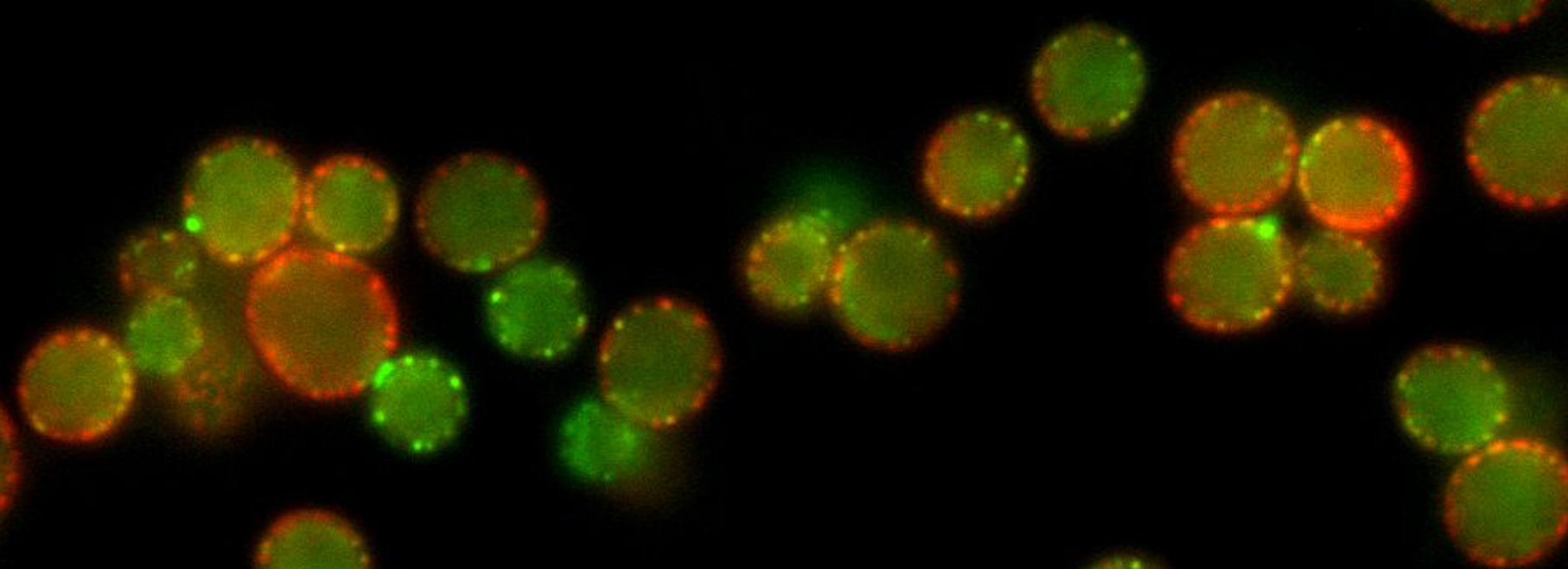 Fluorescence microscopy of yeast cells expressing different proteins fused to the Green Fluorescent Protein and Red Fluorescent Protein. Imatge inicial - Fluorescence microscopy of yeast cells expressing different proteins fused to the Green Fluorescent Protein and Red Fluorescent Protein.