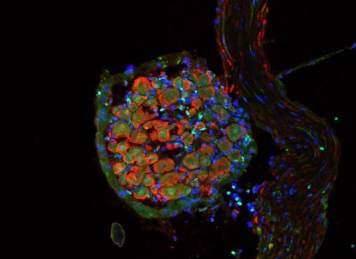 Células inmunes marcadas con una proteína fluorescente verde que indica la presencia del receptor cannabinoide tipo 2 (CB2) infiltran el nervio lesionado de un ratón. La presencia de fluorescencia a nivel neuronal (rojo, neuronas) sugiere transferencia del receptor cannabinoide de células inmunes a neuronas. El color azul marca los núcleos celulares. Crédito: Angela Ramírez-López, David Cabañero y Rafael Maldonado, Laboratorio de Neurofarmacología-NeuroPhar DOI: 10.7554/eLife.55582. Imatge inicial - Células inmunes marcadas con una proteína fluorescente verde que indica la presencia del receptor cannabinoide tipo 2 (CB2) infiltran el nervio lesionado de un ratón. La presencia de fluorescencia a nivel neuronal (rojo, neuronas) sugiere transferencia del receptor cannabinoide de células inmunes a neuronas. El color azul marca los núcleos celulares. Crédito: Angela Ramírez-López, David Cabañero y Rafael Maldonado, Laboratorio de Neurofarmacología-NeuroPhar DOI: 10.7554/eLife.55582.
