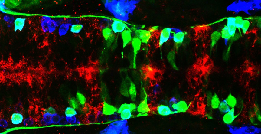 Imagen: Visión dorsal de cerebro de embrión de pez cebra, que la investigación de Cristina Pujades utiliza como sistema modelo