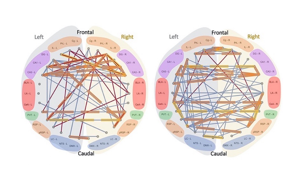 Graphs showing the connectivity of the networks in the different areas of the brain, under normal conditions (No stimulation) and with transcutaneous electrostimulation (atVNS). Each line represents the correlative activity of the activity of the indicated brain areas. Imatge inicial - Graphs showing the connectivity of the networks in the different areas of the brain, under normal conditions (No stimulation) and with transcutaneous electrostimulation (atVNS). Each line represents the correlative activity of the activity of the indicated brain areas.