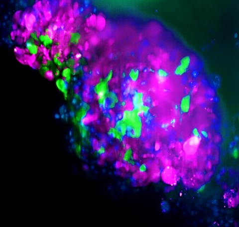 Organoide donde las células de color verde son las células madre cancerígenas que no expresan LCOR. Fuente IMIM. Imatge inicial - Organoide donde las células de color verde son las células madre cancerígenas que no expresan LCOR. Fuente IMIM.