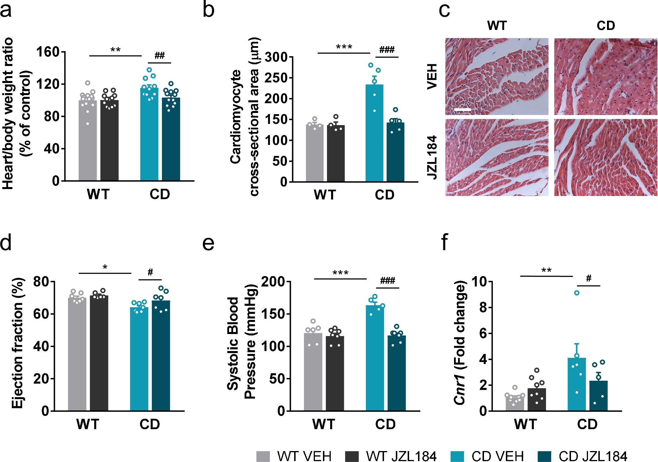 JZL184 administration regresses cardiac hypertrophy and the expression of cardiac Cnr1 alterations of complete deletion (CD) mice