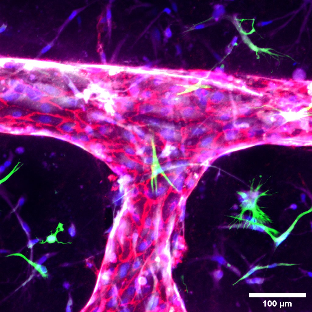 Imagen de la investigación en malaria de Maria Bernabeu. En rojo vasos sanguíneos / células endoteliales en 3D y astrocitos en verde. Fuente: EMBL Barcelona.