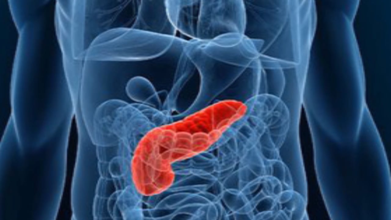 Pancreatic cancer