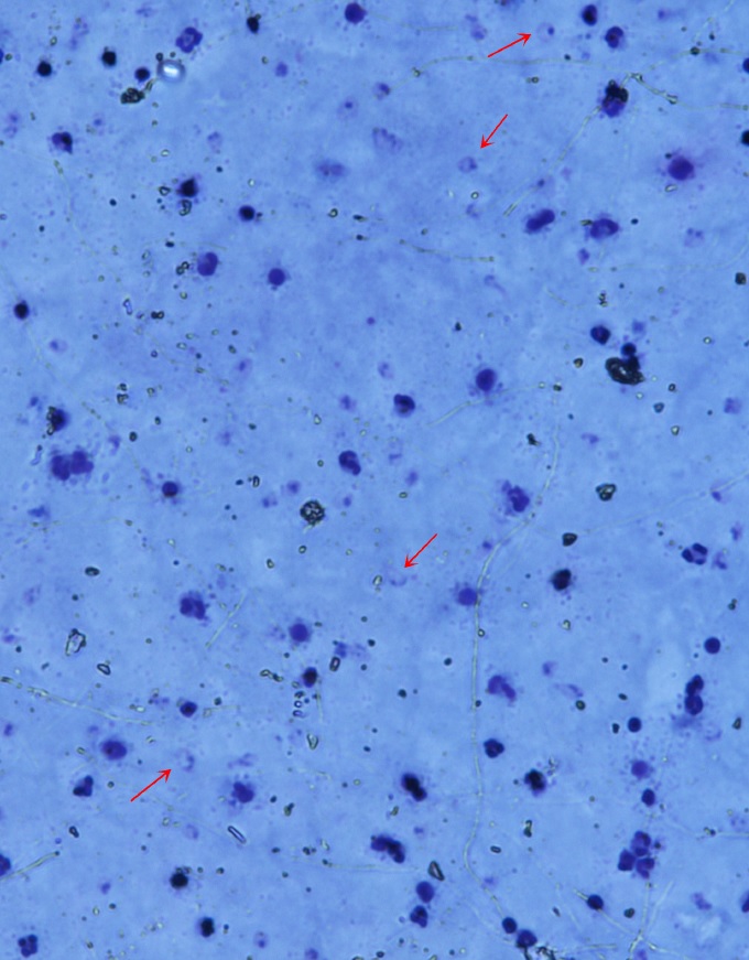 Fotografia 2: Sota el microscopi, a 400 augments, poden distingir-se el paràsits de malària. (IBE, CSIC-UPF)