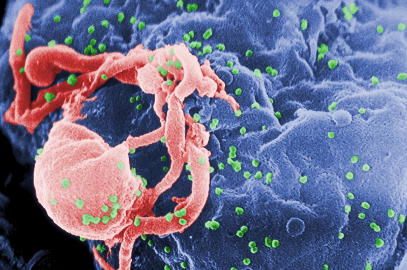 Microfotografia amb MEB de VIH-1 en alliberament (en verd) en un cultiu de limfòcits - Wikimedia Commons