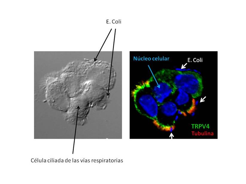 Atac de bacteris Escherichia coli a les cèl•lules ciliades del pulmó - UPF