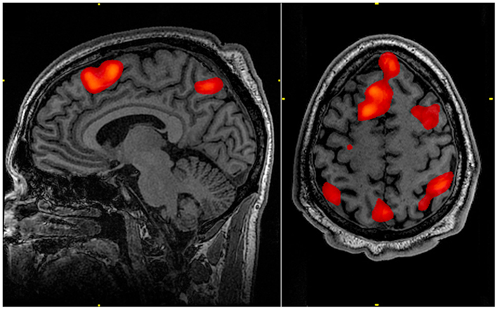 FMRI scan during working memory tasks - John Graner