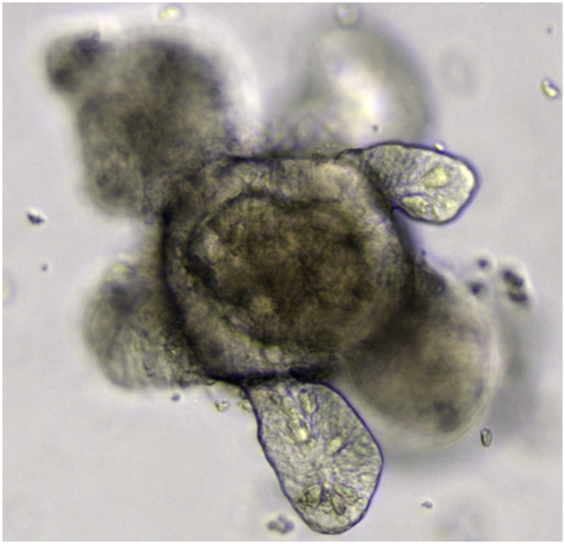 Intestinal organoid - By Meritxell Huch, via Wikimedia Commons