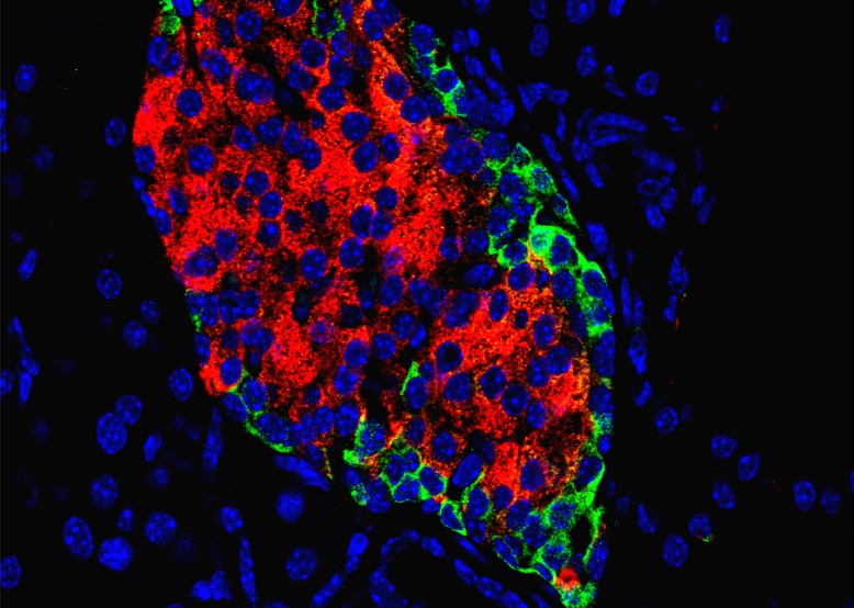 Imatge de microscòpia confocal dels illots pancreàtics on es troben les cèl·lules beta. Imatge inicial - Imatge de microscòpia confocal dels illots pancreàtics on es troben les cèl·lules beta.