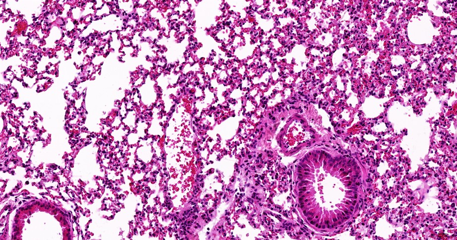 Detail of lung tissue. Credit: Ivan Zadra, UPF. Imatge inicial - Detail of lung tissue. Credit: Ivan Zadra, UPF.