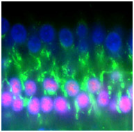 Hair cells