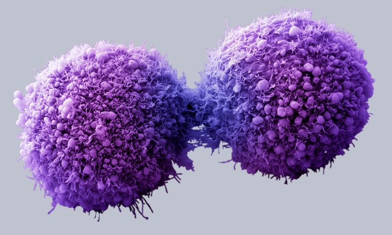 Cèl·lules de pàncrees canceroses completant la divisió cel·lular - Getty Images/Visuals Unlimited